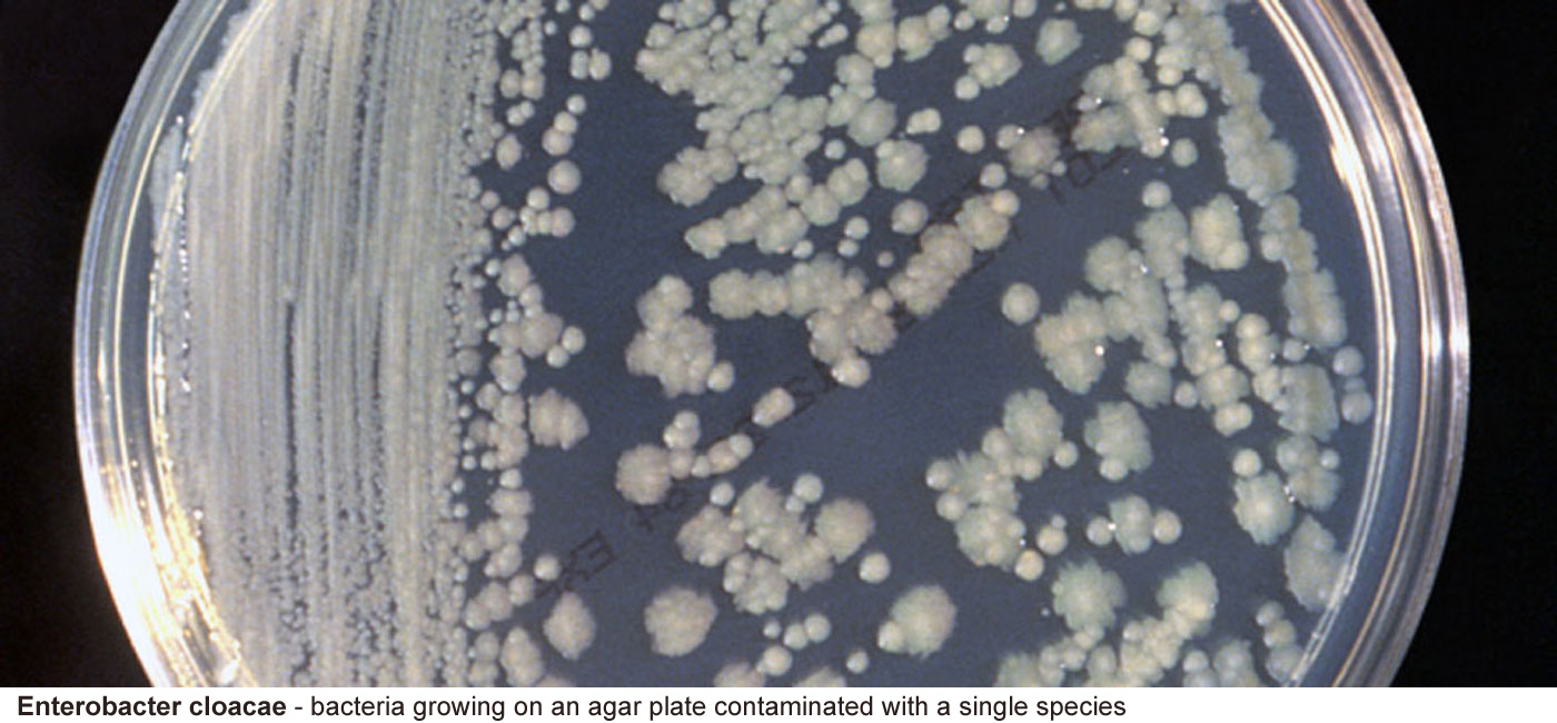 Enterobacter cloacae - Bacteria growing on an agar plate. The plate 
								has a layer of agar derived from sea weed 
								with added nutrients, In this case it has been 
								contaminated with a single bacterial species
