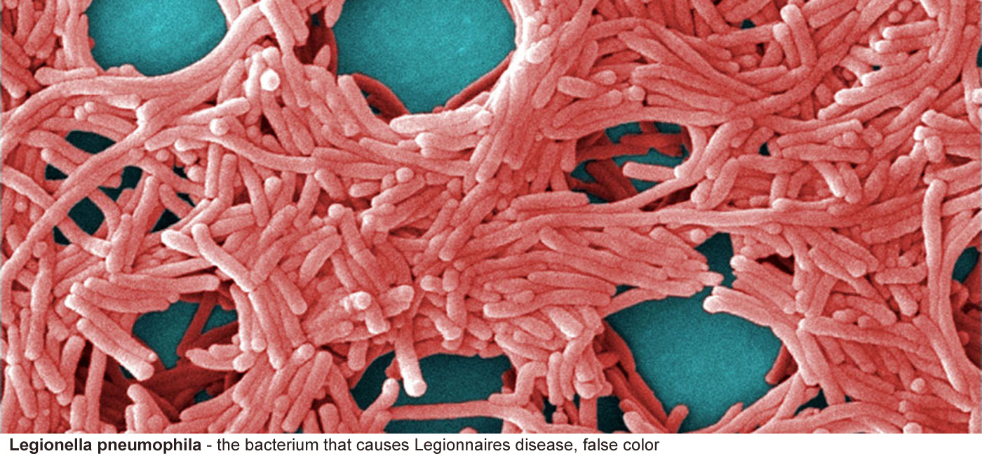 Legionella pneumophila - A false color image of the bacterium that 
								causes Legionnaires disease
