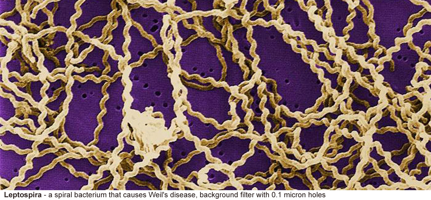 Leptospira - The spiral bacterium that causes Weil's disease 
								the bacteria are on a filter with holes of 
								0.1 micron diameter. False color.