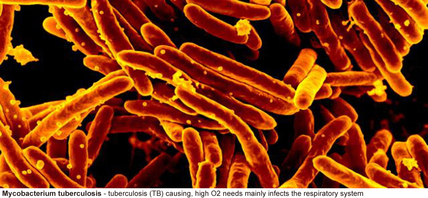 Mycobacterium tuberculosis - The bacterium that is responsible for most 
								causes of tuberculosis (TB) a requirement for 
								high levels of oxygen make this a pathogen that 
								mainly infects the respiratory system. False 
								color.