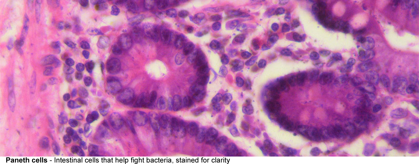 Paneth cells Intestinal cells that help<br>fight bacteria