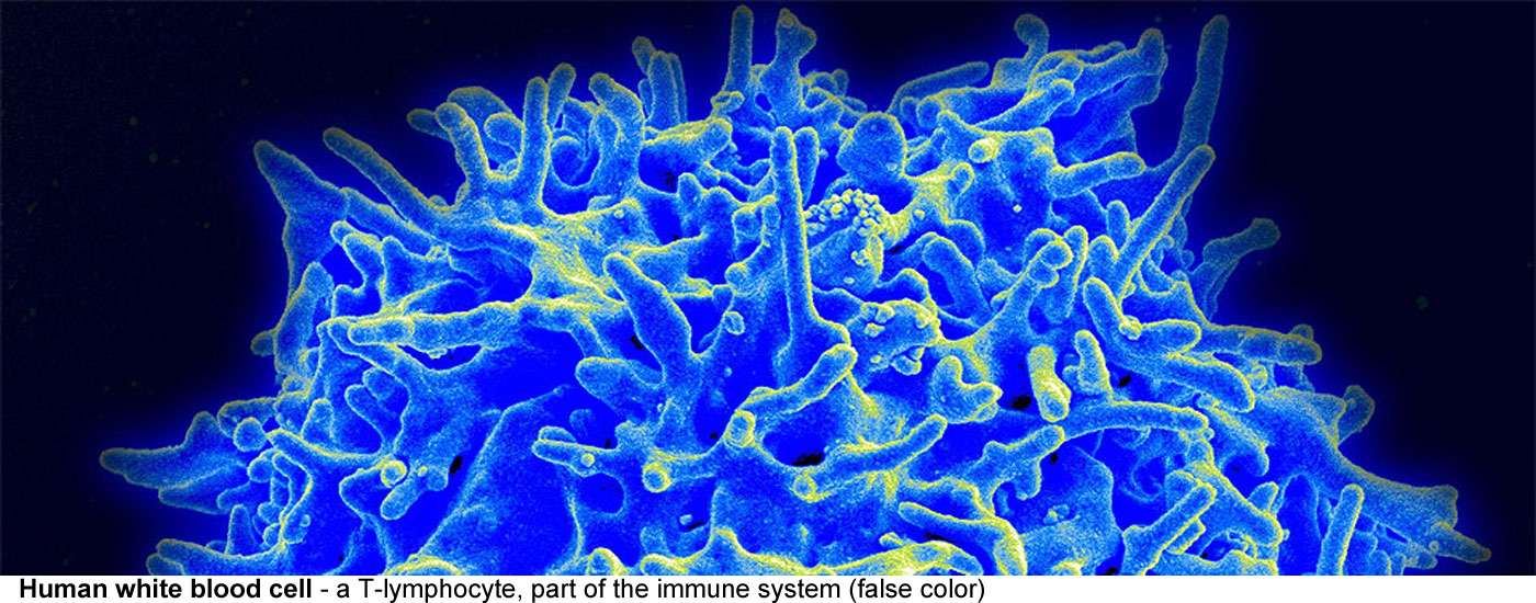 Xylem vessels in Tilia (lime) wood - Xylem vessels are dead cells that provide support and transport 
  water and mineral ions. Annular (ring) and spiral thickenings of lignin can be 
  seen