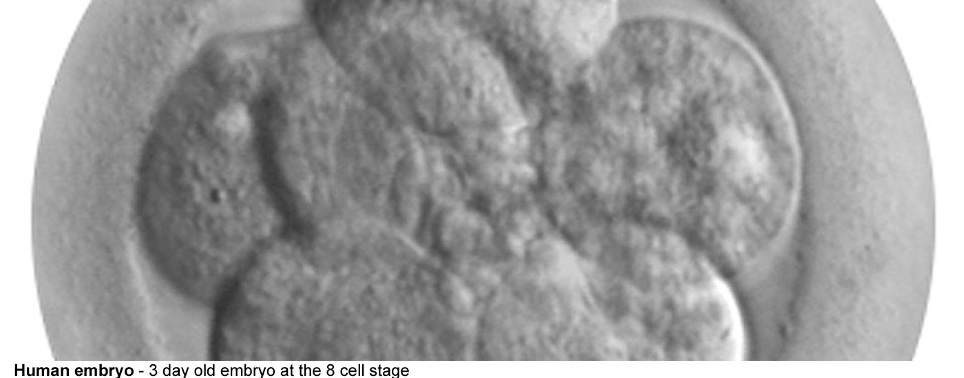 stomata - The lower epidermis of a leaf showing stomata with their guard 
  cells. These structures control the exchange of gases in the leaf and 
  limit water loss