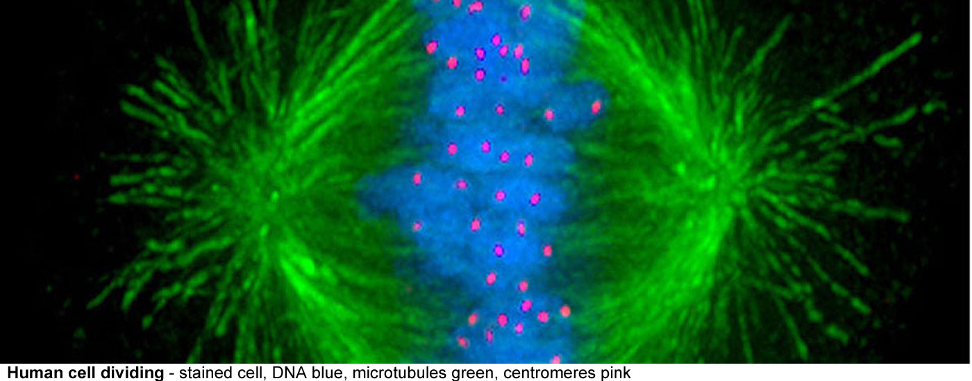 Vascular bundle in sunflower stem - The red walls are of xylem vessels, at least two of them have spiral thickening as seen bythe loose  cut ends of the lignin stained 
red. These are dead cells that carry water and dissolved minerals Nearby cells are phloem that carry sugars and other products of photosynthesis.