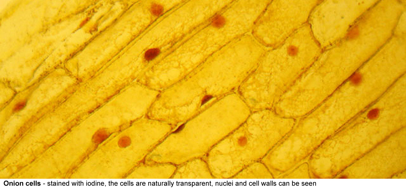 Onion cells - Stained here with iodine the cells are naturally transparent the 
  cellulose cell wall and vacuoles can be seen onions don't have 
  chlorophyll in the onion bulb